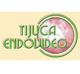 Tijuca Endovideo